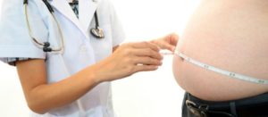 Doctora midiendo la cintura de una persona con obesidad